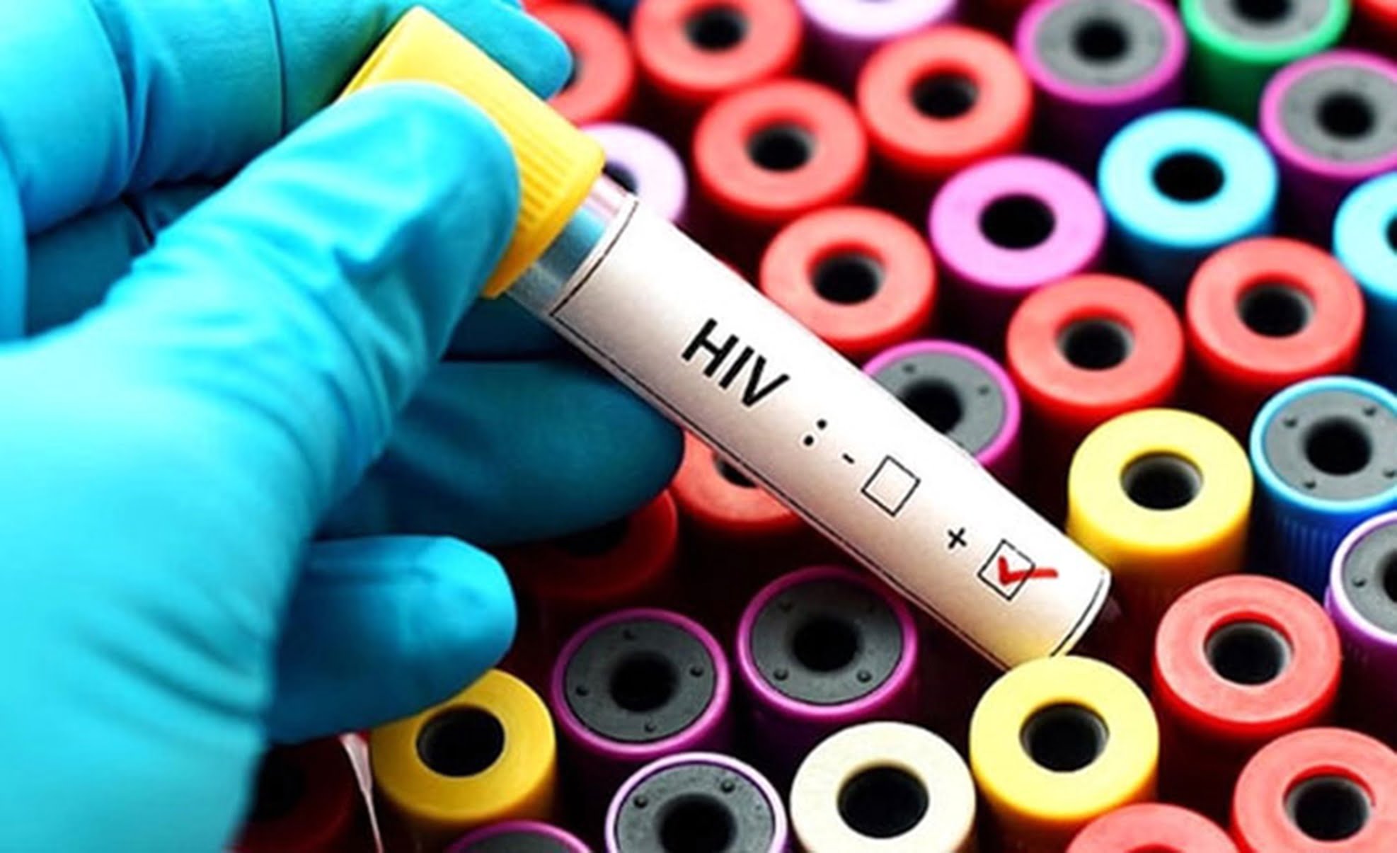 HIV Virüsü Nedir